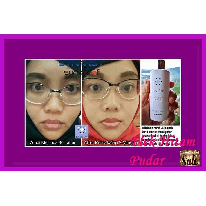 

EYEKRIM- CREAM UNTUK FLEK HITAM | PEMUTIH WAJAH ALAMI NON KIMIA -ASLIII.