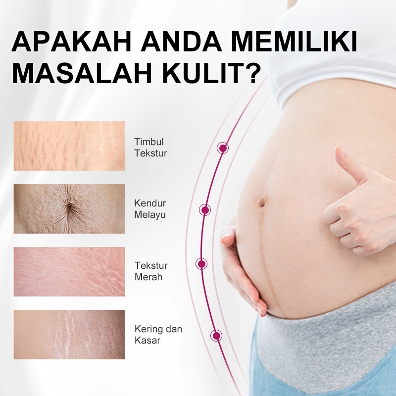 [BPOM]RtopR Mangga Menghilangkan Bekas Kehamilan Krim Jerawat Stretch Marks Perawatan Bersalin Perbaikan Anti-Penuaan Anti-Keriput Mengencangkan Krim Tubuh 40g