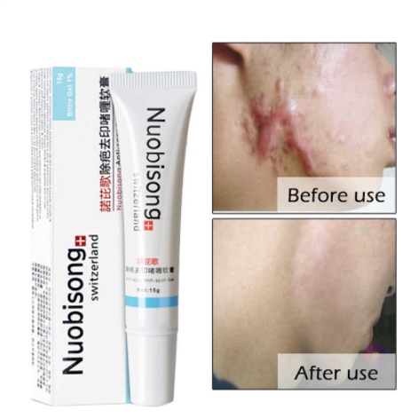 Nuobisong Obat Penghilang Bekas Luka /Jerawat / Selulit Scar Gel