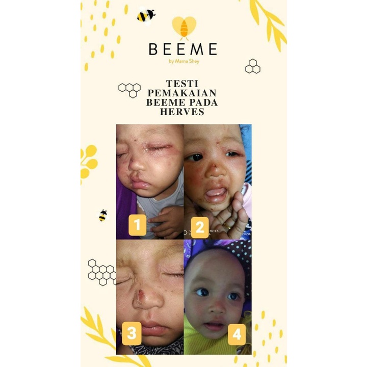 Beeme Nourishing Balm | SKINCARE IBU DAN ANAK / Bee Me