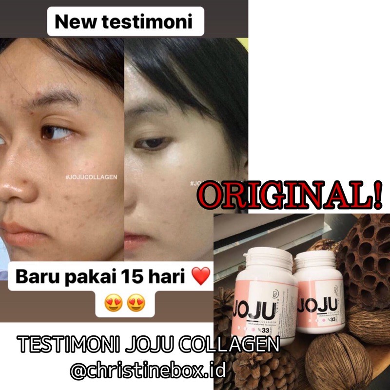 Joju Collagen Obat Jerawat Suplemen Indonesia