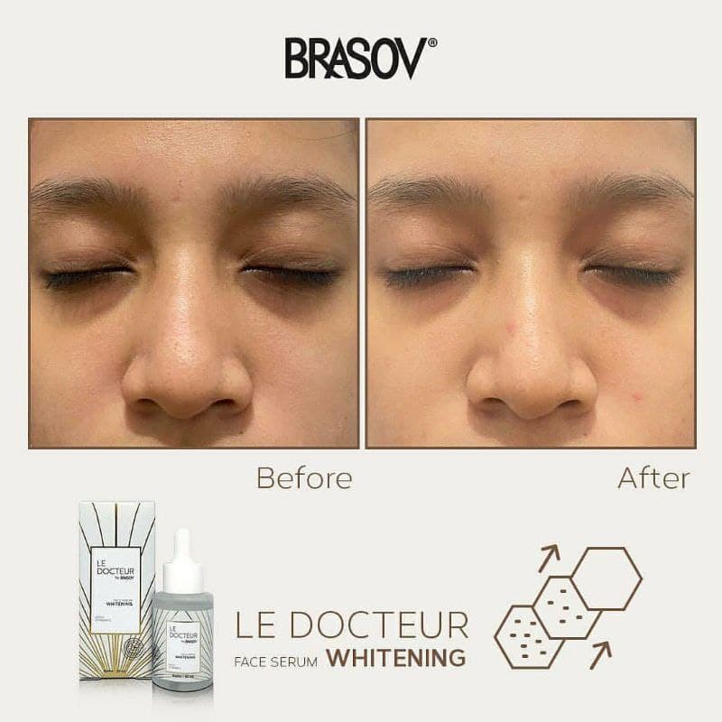 BRASOV Face Serum Le Docteur With Vitamin C BPOM &amp; Halal