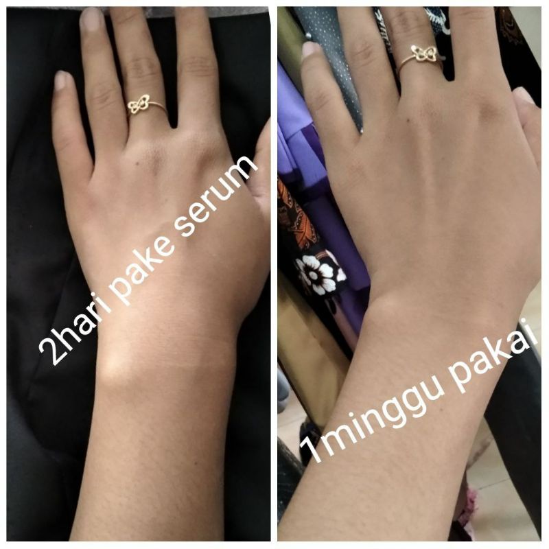 GARANSI ORI !!!(COD)Body serum Kedas Beauty ORI/Brightening Body serum Kedas Beauty 100% ORIGINAL-3