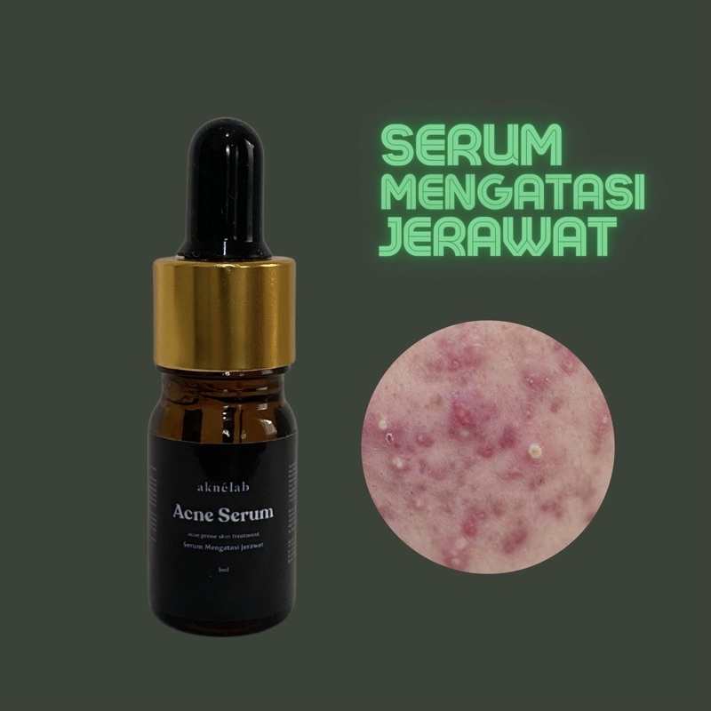 Serum Anti-Acne Aknèlab 10ml (Acne)