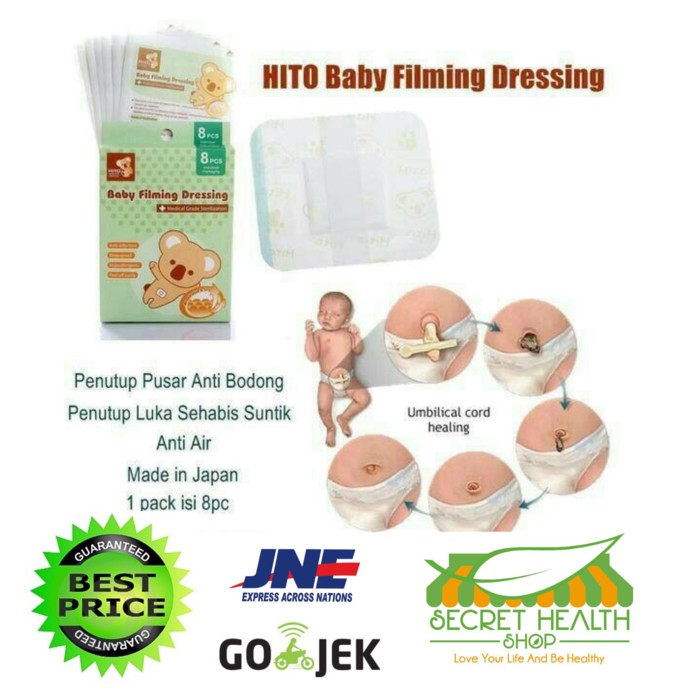 Hito Baby Filming Dressing Penutup Pusar Bayi Anti Bodong