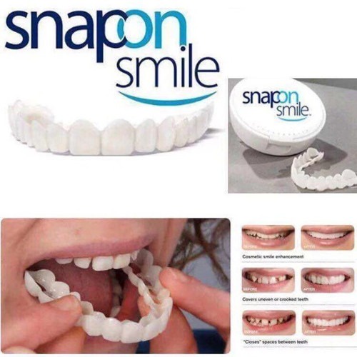 Snap On Smile Gigi Palsu 1 Set Atas Bawah - Gigi Palsu Silikon