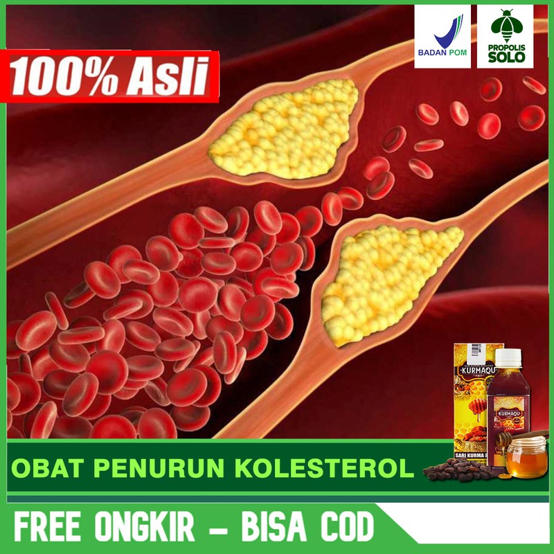 Obat Penurun Kolestrol, Darting, Darah TinggiTerlaris Madu & Sari Kurma Di SOLO Bisa COD
