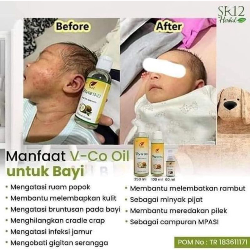 VCO SR12 Untuk Bayi VCO untuk ruam pada bayi VCO Oil Original BPOM