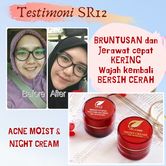 Skincare Wajah Berjerawat BPOM | Acne Series SR12 Skincare | Acne Moist | Acne Totol | Acne Serum | Acne Toner | Solusi Ampuh Atasi Jerawat | Menghilangkan Jerawat dan Bekas Jerawat | Krim Jerawat | Jerawat Bruntusan | Jerawat Batu | Jerawat Membandel