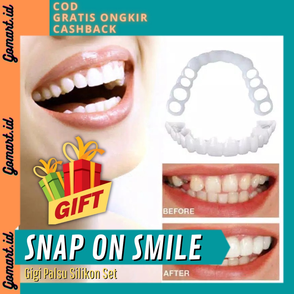 Snap On Smile Gigi Palsu 1 Set Atas Bawah - Gigi Palsu Silikon