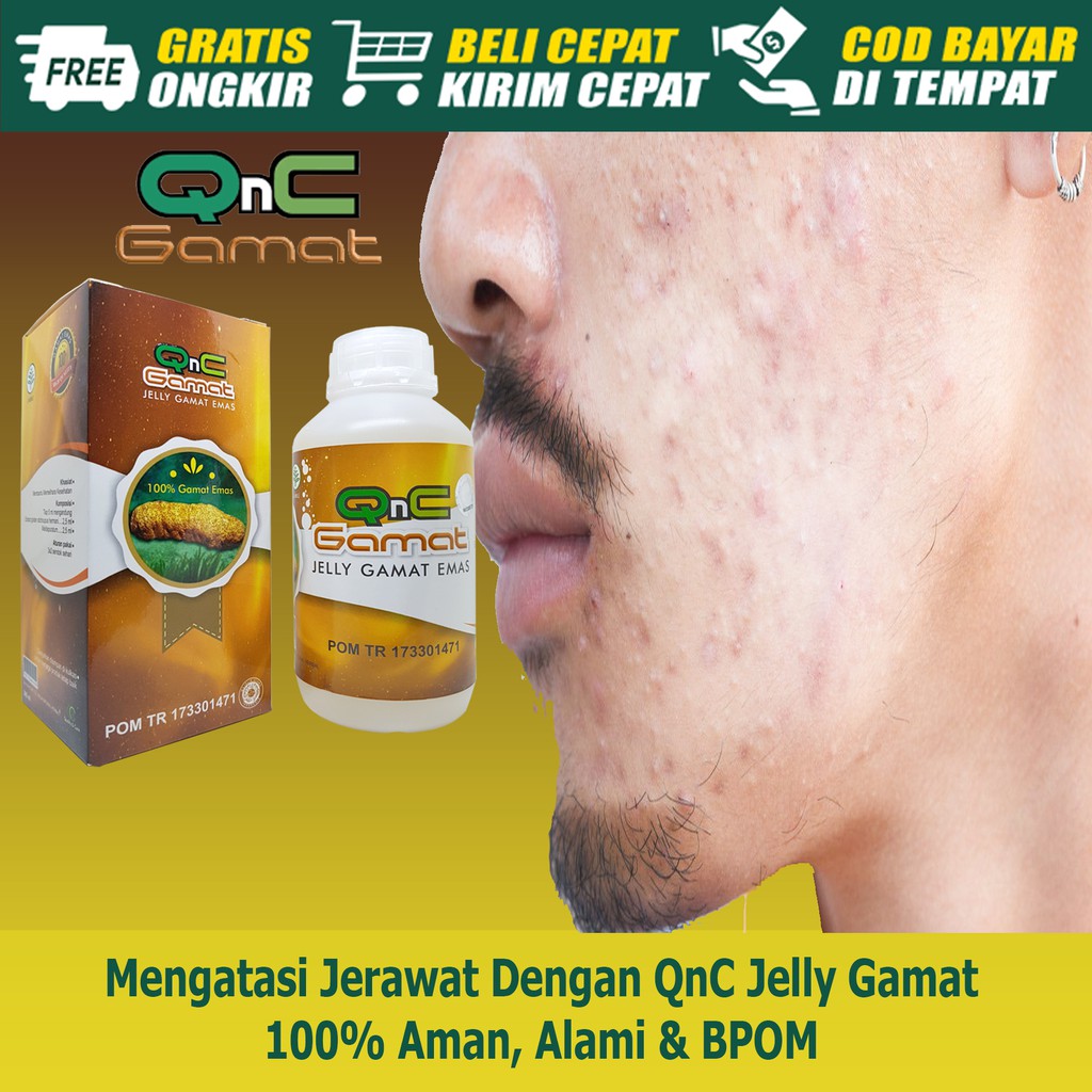 COD Obat Jerawat Alami Oles & Minum, Jerawat Di Punggung/Wajah/Dada/Badan, Penghilang Bekas Jerawat