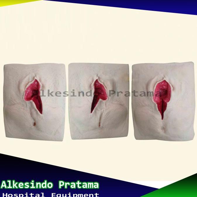 Manekin Episiotomy Model | Manikin Phantom Suture Simulasi Training