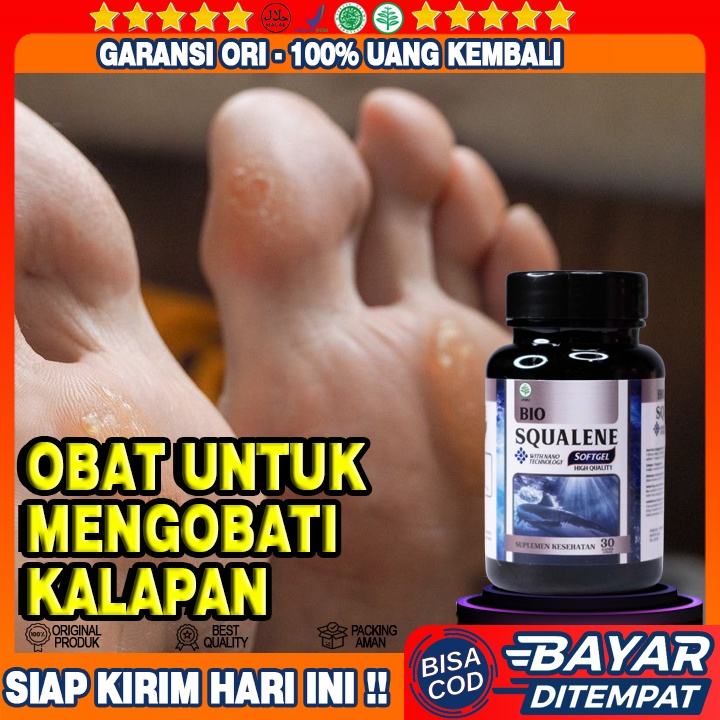 Obat Kapalan - Obat Kaki Kapalan Pecah Kasar Kering - Obat Kapalan Di Kaki - Obat Kapalan Di Tanganm