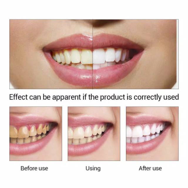 ORI Tooth Whitening Powder Pembersih Karang Gigi Plak Essence Penghilang Gigi Kuning Teeth Whitening