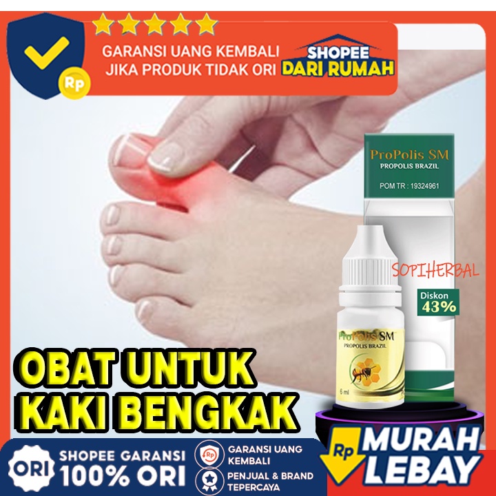 Jual Obat Jempol Kaki Bengkak Cantengan Kuku Tangan Luka Di Jempol