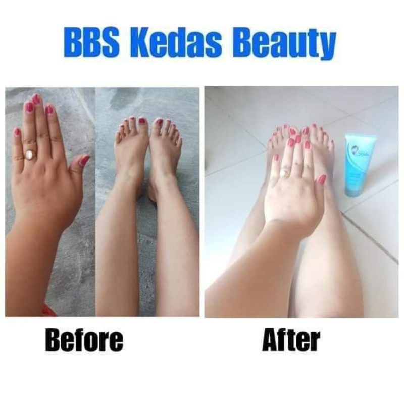 produk kedas Beauty body serum & sabun Kedas Beauty