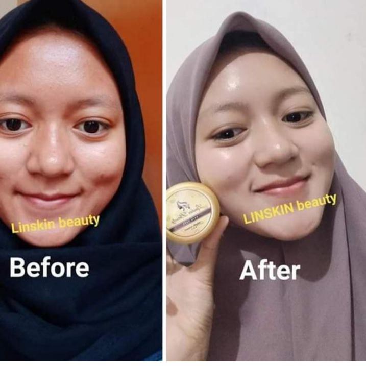[Promo MidYear] - Skincare ALL IN ONE Linskin Beauty