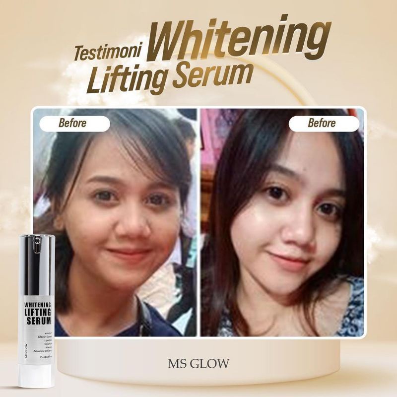 Lifting Whitening Serum 15 ml MS GLOW