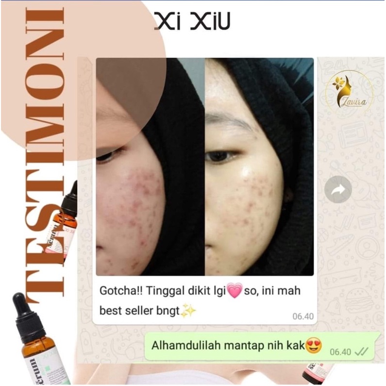 serum wajah viral xi xiu vit c/acne/gold bpom xixiu termurah/terbaru essense pelicin kulit muka peng