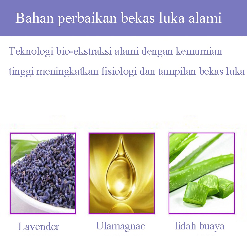 penghilang bekas luka  jerawat  hitam koreng30g+30g permanen ASLI Original Obat penghilang bekas jerawat bopeng Wanita Cowok Cewek Laki Laki