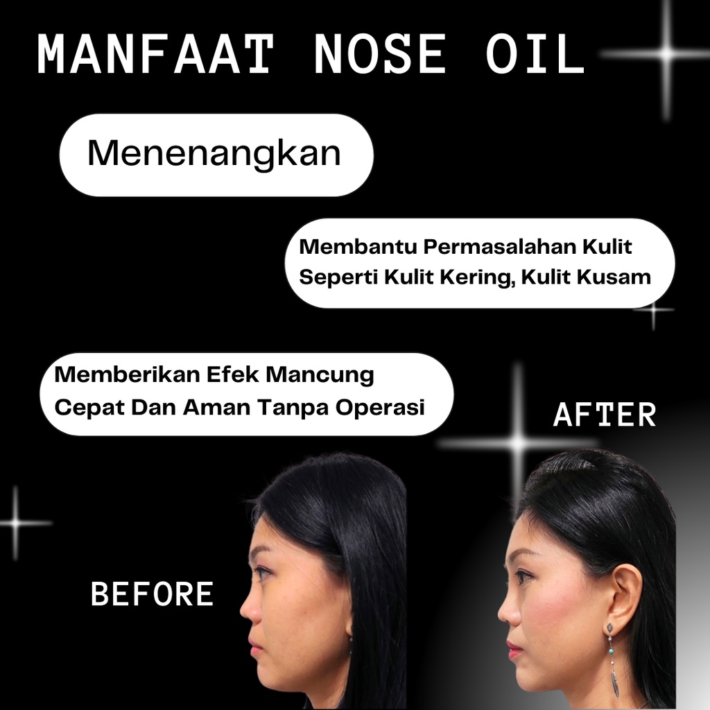 Alat Obat Minyak Pemancung Memancungkan Hidung Permanen Mancung Alami Pria Dan Wanita Ampuh Nose Up Lift Essential Oil Serum 10 Ml Penjepit Pengecil Hidung Besar Kecil 100% Original