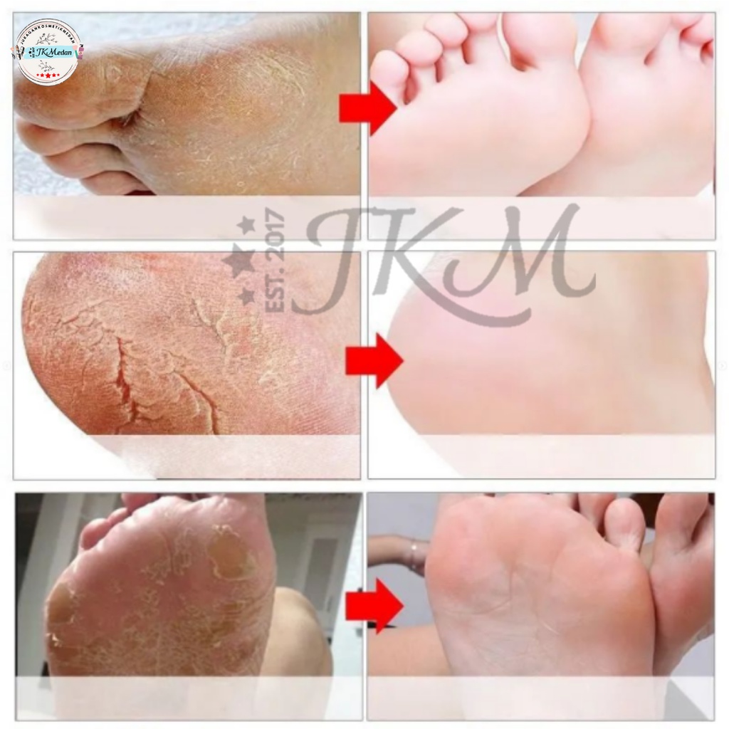 EFERO EXFOLIATING FOOT CARE MASK MASKER KAKI EFERO MASKER KAKI BIOAQUA FOOTMASK EFREO HANDMASK PUTIMI HANDMASK ALOEVERA