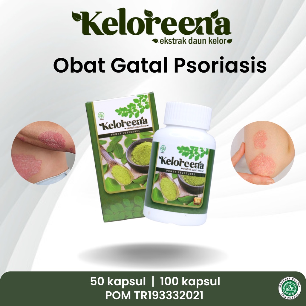 Sapnu Herbal - Obat Psoriasis, Psoriasis Menahun, Psoriasis Kulit Kepala, Gatal Kulit Psoriasis, Pso