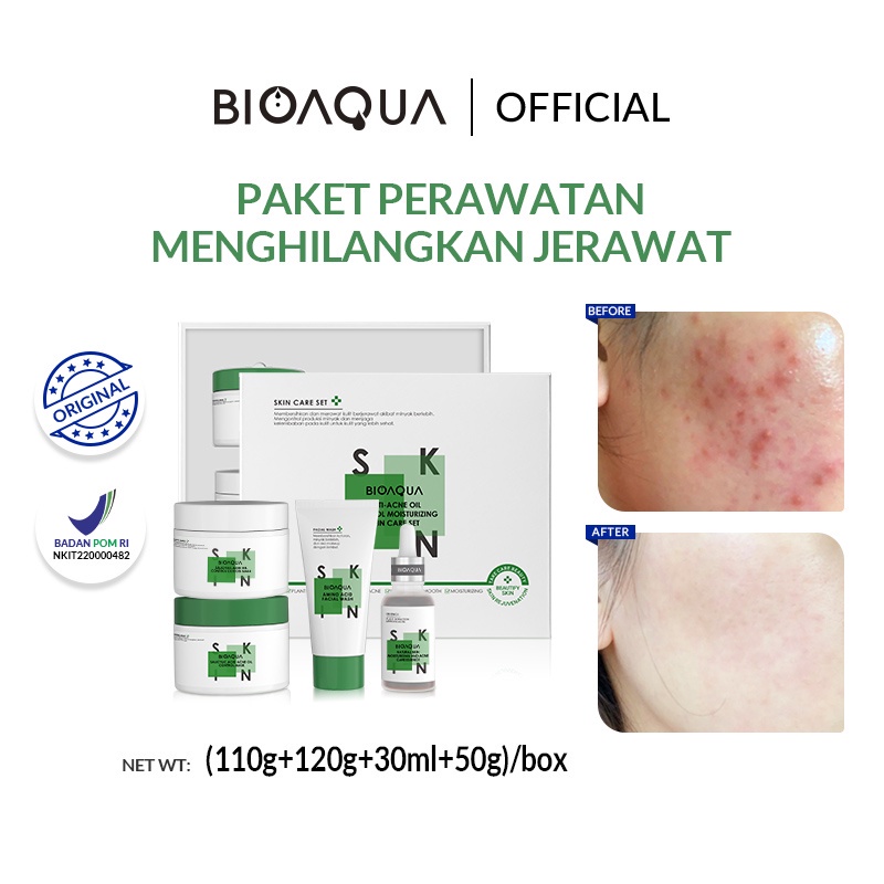 ✨ AKU MURAH ✨ BIOAQUA PAKET Anti-Acne Oil Control Moisturiz ing Skin Care Set (110G+120G+30ml+50G)