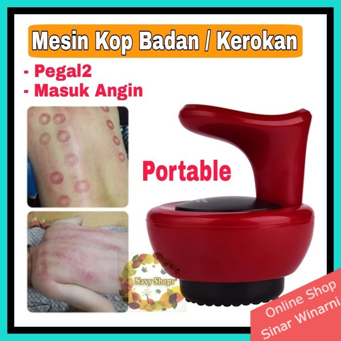 Alat Terapi Bekam, Alat Pijat Kerik Terapi Fisik Genggam dengan Hisap Panas LUYAO