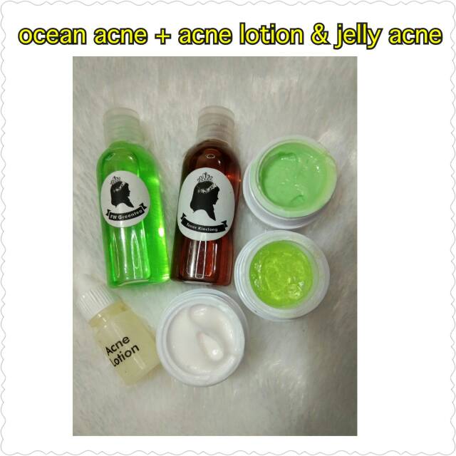 Crown Skincare paket ocean acne+ acne & jelly acne