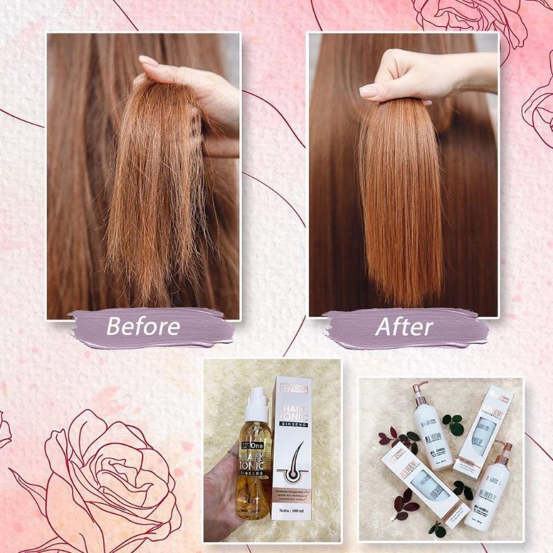 MyOne Renew Shampoo Anti Rontok Anti Lepek dan Hair Tonic BPOM-4