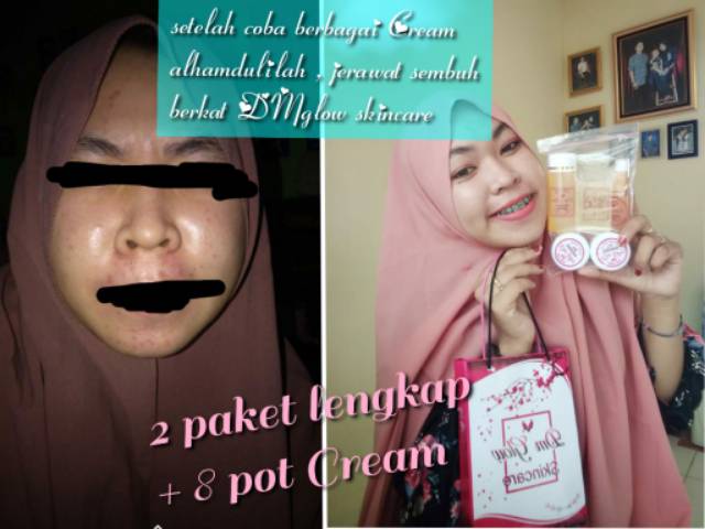 dm glow cream