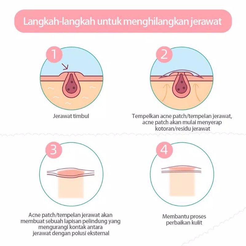 Premium Acne Pimple Patch Sticker Jerawat Pembersih Jerawat