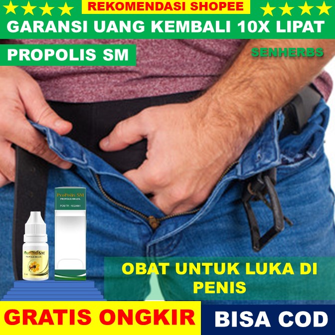 Jual Obat Luka Di Penis Obat Luka Lecet Di Penis Gatal Pada Kemaluan