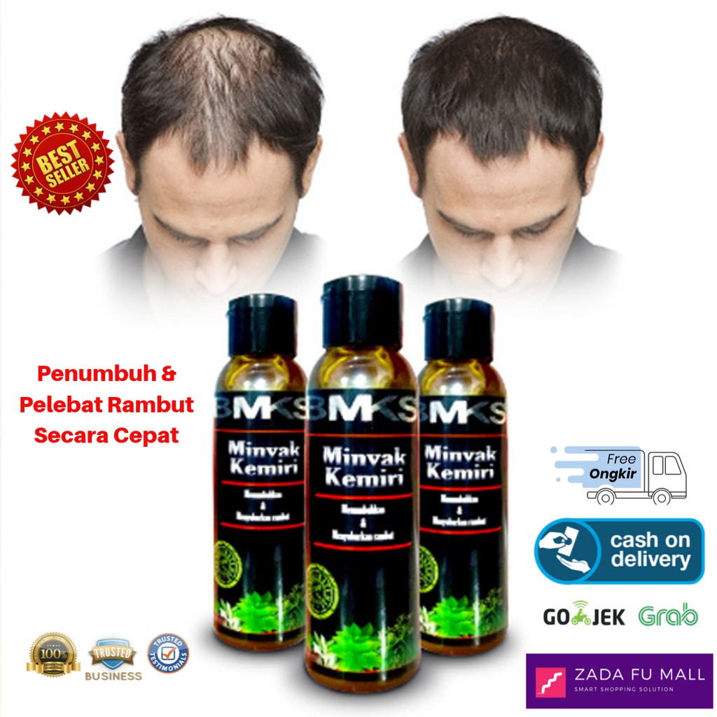 Penumbuh Rambut Botak Minyak Kemiri Asli Bpom Obat Uban Penghitam Penyubur Rontok Bmks Original Shopee Indonesia