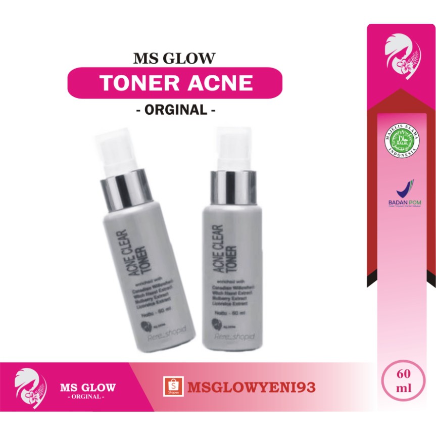 Toner Acne Ms Glow/ Ms Glow Toner Acne