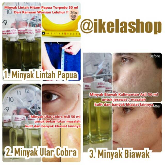 Minyak Biawak /Lntah Papua / Ular Cobra