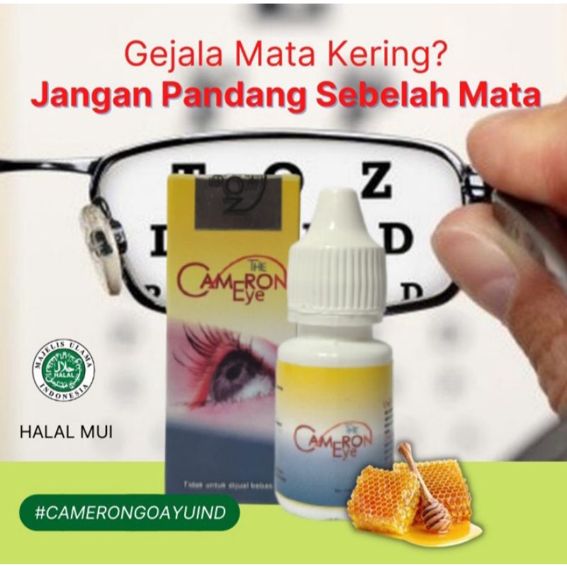 THE/CAMERON/EYE/BUNGA/KITOLOD/AMPUH/UNTUK/MATA/MINUS