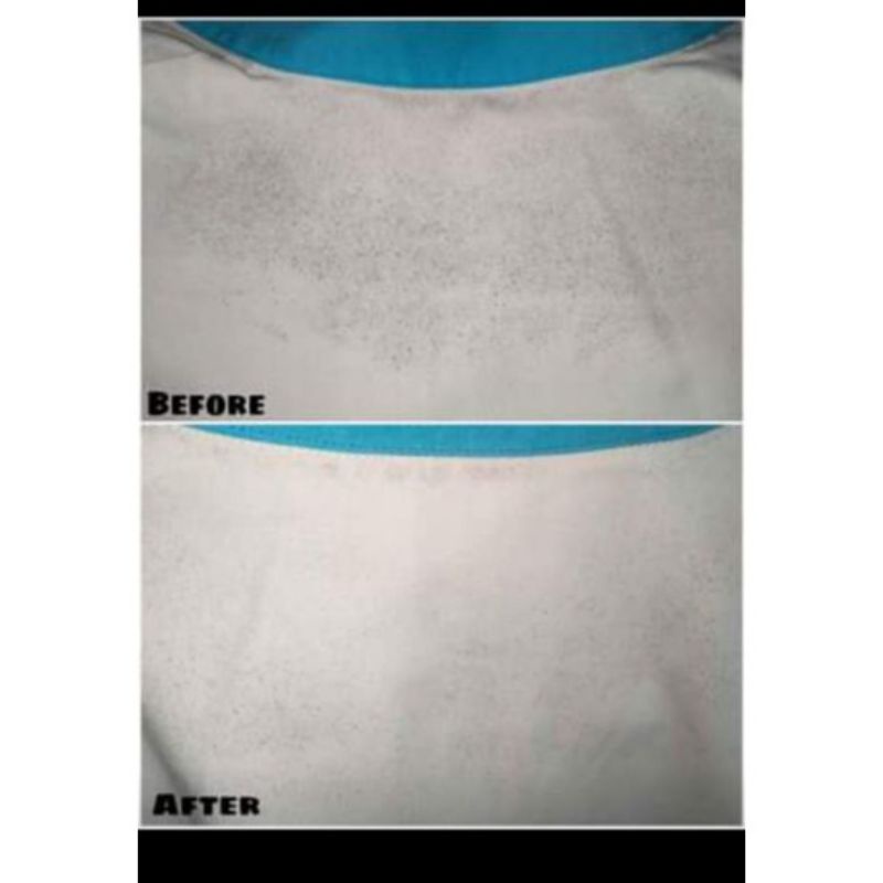 ‼️READY‼️obat jamur NR - obat pembersih Tai manan - obat penghilang jamur - OBAT JAMUR PAKAIAN