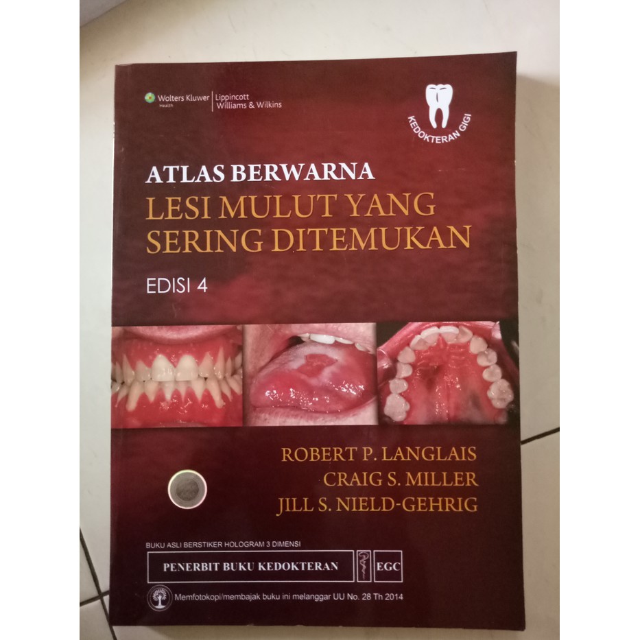Buku atlas berwarna Lesi mulut yang sering ditemukan edisi edisi 4