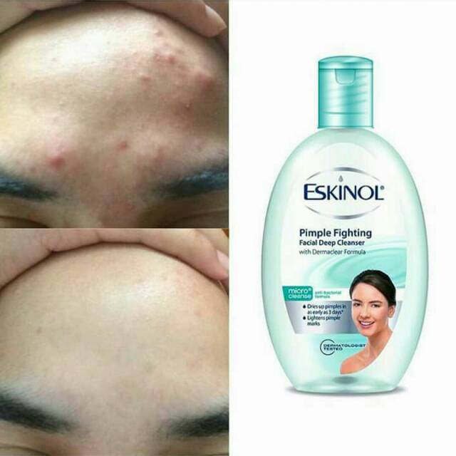 Eskinol Ready Stock Shopee Indonesia