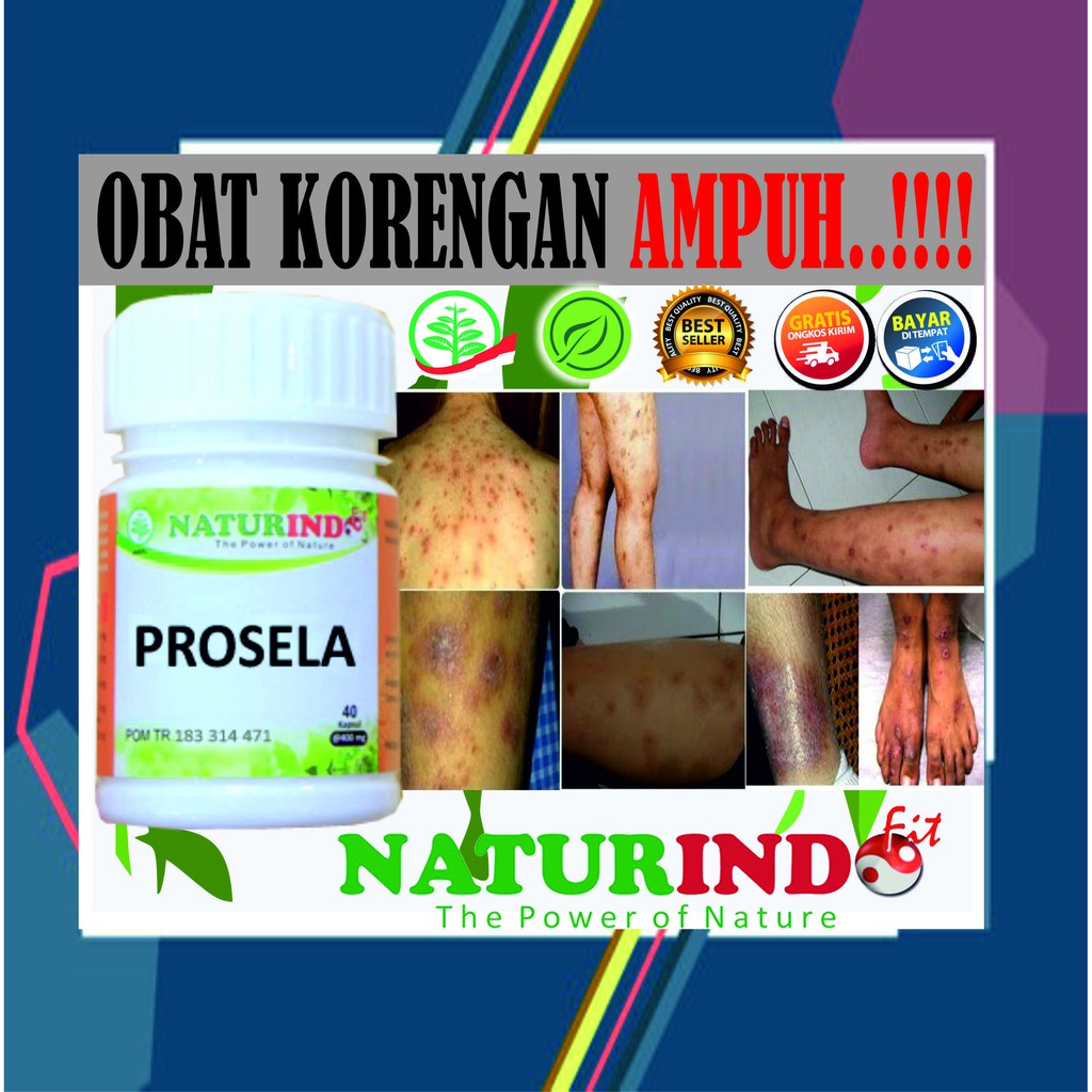 OBAT KORENG KULIT MENGHITAM PENGHILANG BEKAS LUKA KORENGAN GATAL BOPENG PALING AMPUH NATURINDO COD