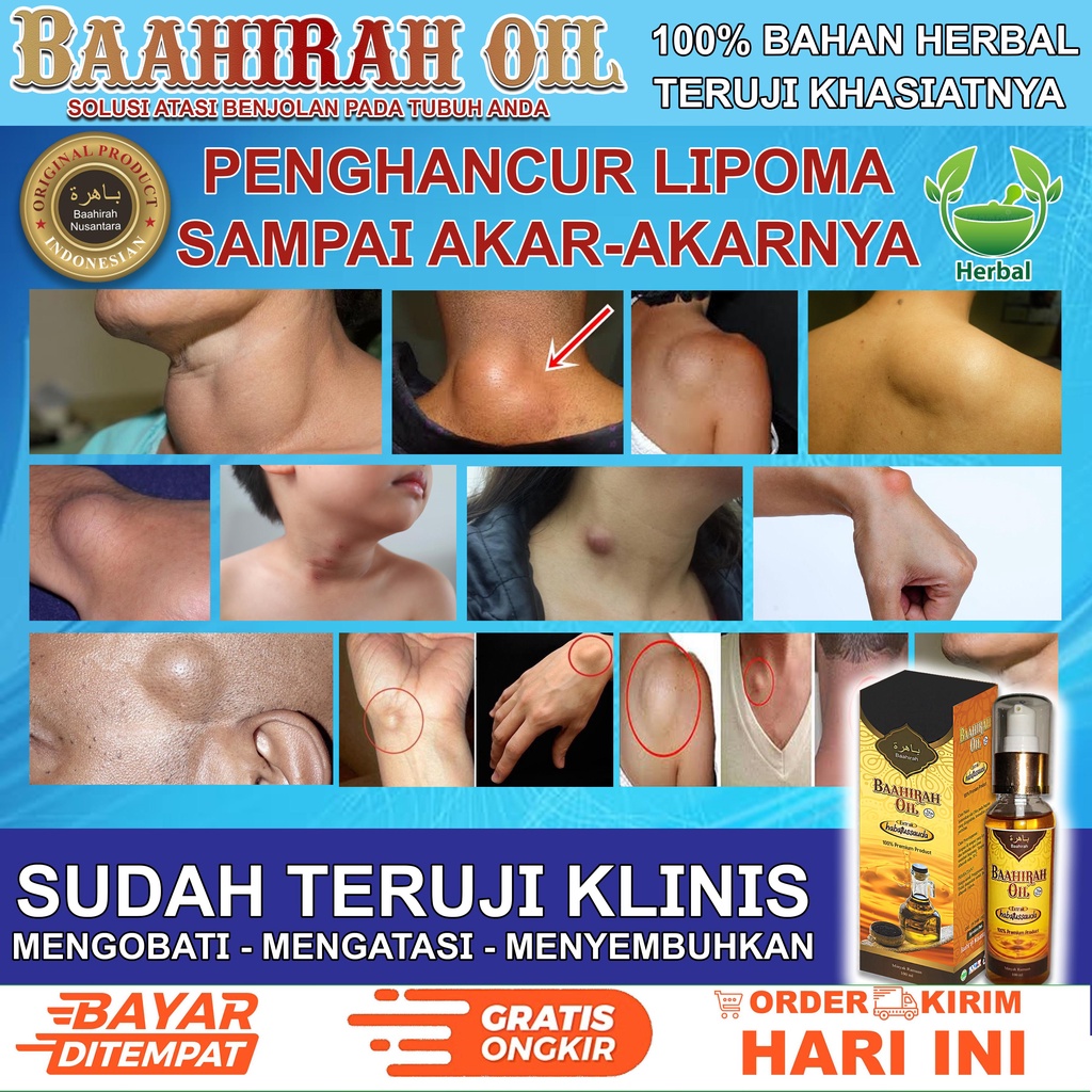 PROMO IDUL ADHA [BAAHIRAH OIL + TEH BAJAKAH + MADU MURNI] .obat benjolan . benjolan dileher , benjolan ditangan. benjolan payudara . lipoma ganglion. tiroid . keloid kelenjar