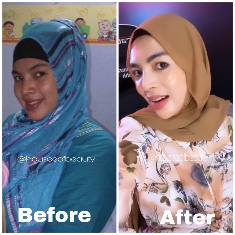 Skincare Cream Pemutih Wajah GLOWING Kosmetik Wanita | NEW SKIN YOUTH REVOLUTION PLUS-5