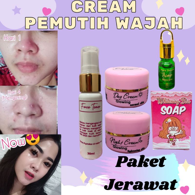 Cream pemutih wajah ampuh (PAKET JERAWAT + SERUM JERAWAT) Cream pemutih wajah ampuh SKINCARE
