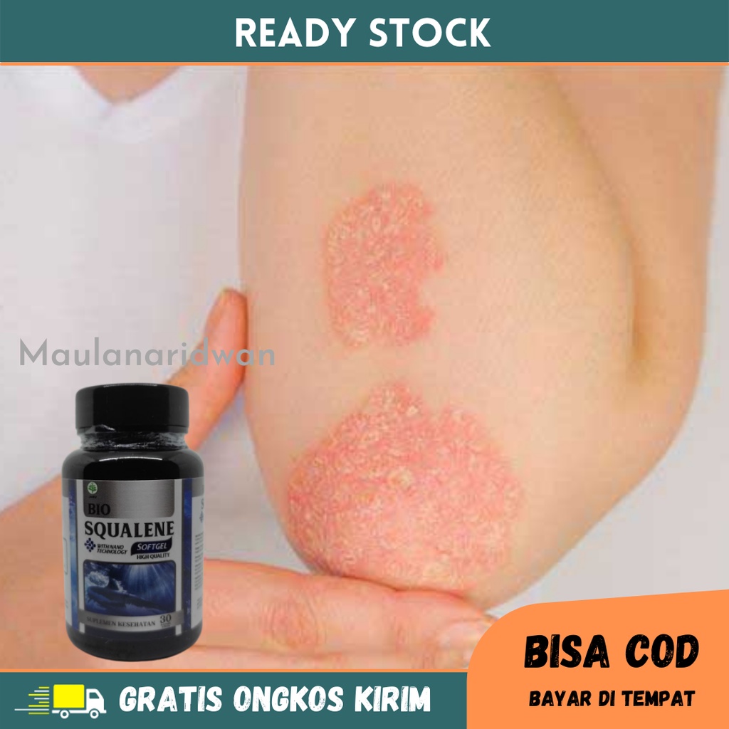 Obat Gatal Alergi - Obat Kulit Gatal Menahun, Obat Alergi Kulit, Obat Kulit Gatal Anak & Dewasa, Oba