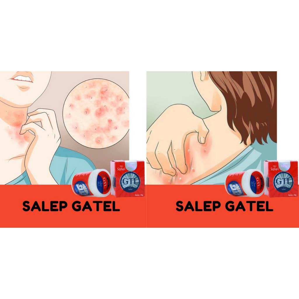 SATEL GTL SALEP GATEL GATAL ORIGINAL 100% BPOM | KULIT KORENGAN, PANU ,KURAP, SALEP SATEL GTL