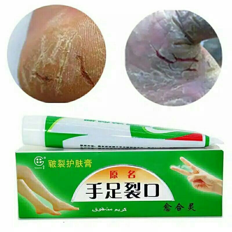 Cream kaki tangan pecah2 Cream tumit kering