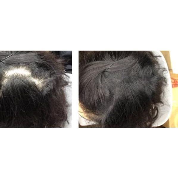 ✲ OCARE HAIR FIBER REFILL 57g HITAM / RAMBUT ANTI BOTAK - Black, 25g ➸