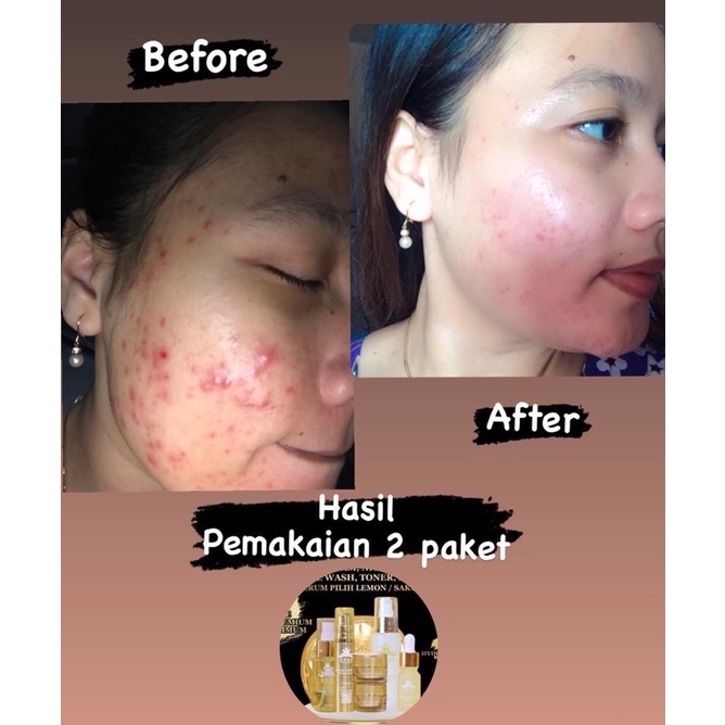 Hyde Beauty Skincare Paket Glowing